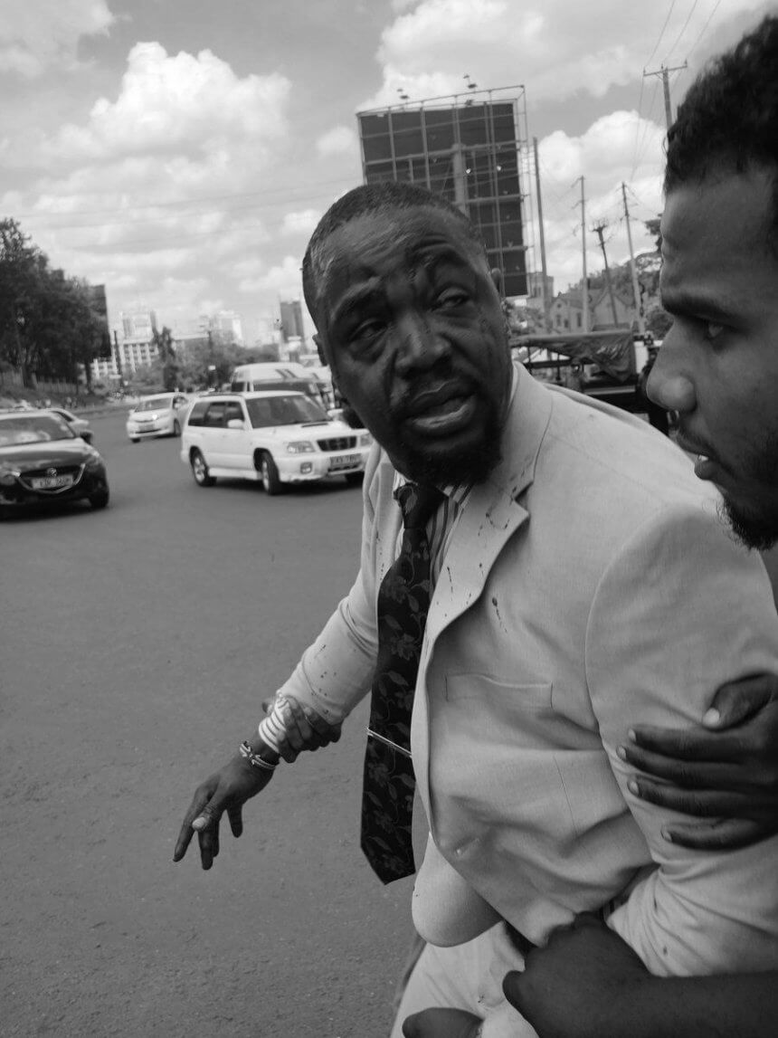 Outrage as Police Open Fire on Medical Protesters; St. Andrews Turi Workers Electrocuted