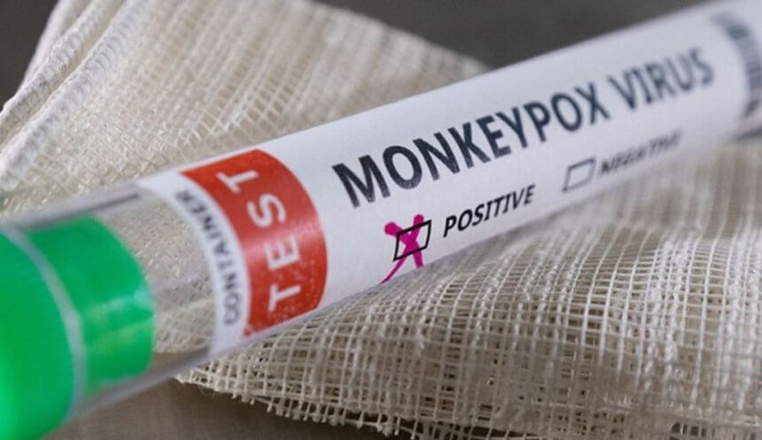 South Africa Records First Mpox Death